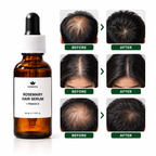 Herbora Rosemary Hair Growth Serum + Vitamin E