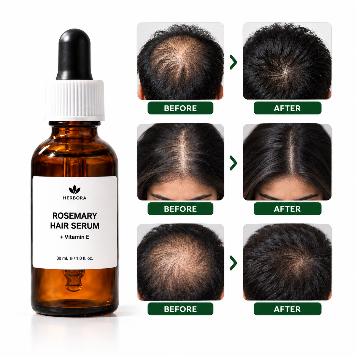 Herbora Rosemary Hair Growth Serum + Vitamin E